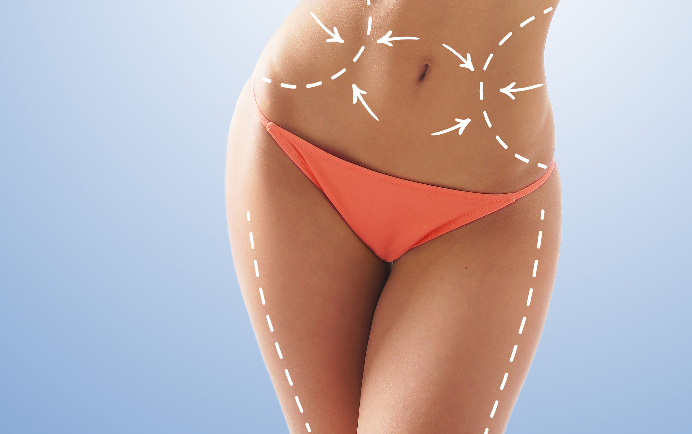 lemon bottle fat dissolving belfast Training available in Northern Ireland UK Lemon Bottle Fat Dissolving Injections