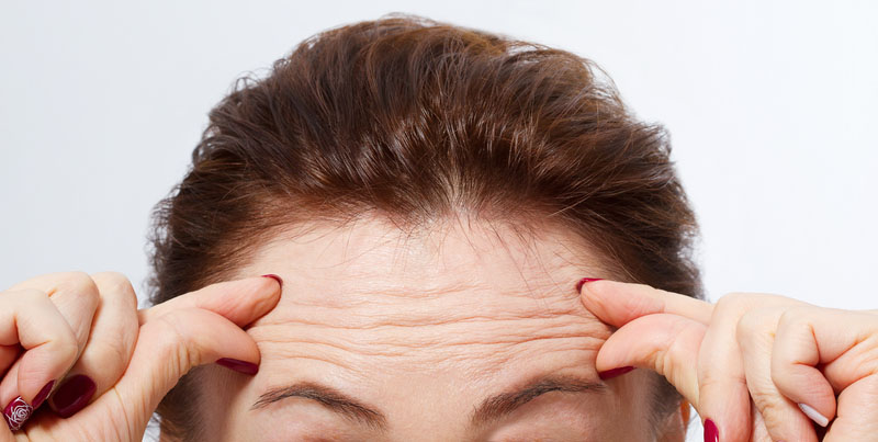 Botox | Anti-wrinkle Injections | Belfast | Lisburn | Cosmetology Clinic | Beauty Beat Lisburn